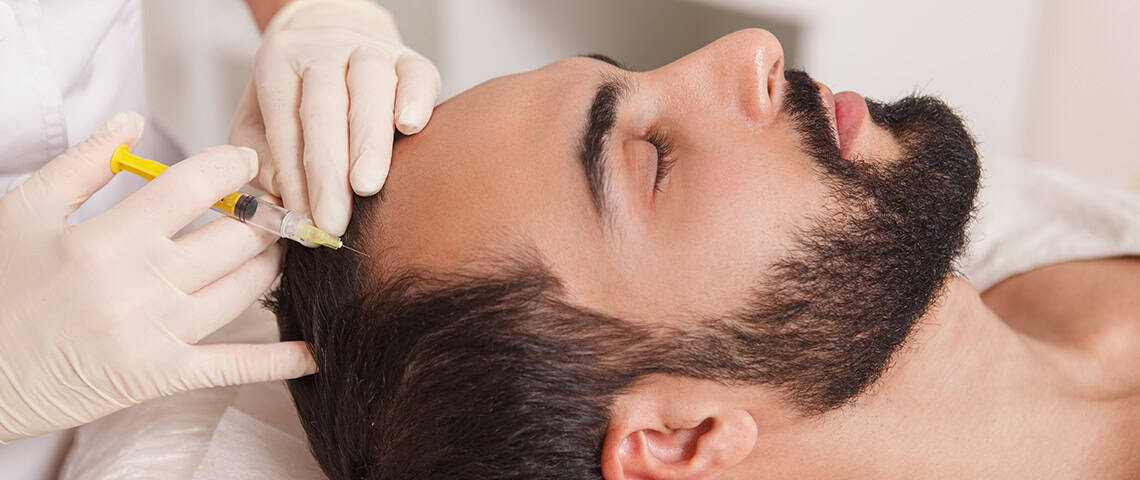 טיפול PRP לשיער ב-In&Out Clinic